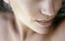 Les taches de pigment sur la personne le laser les rappels