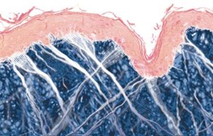 Illustration graphique d’une peau plus vieille