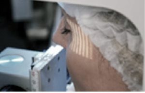 La peau d’une femme subit un test