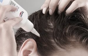 Femme appliquant du produit sur son cuir chevelu
