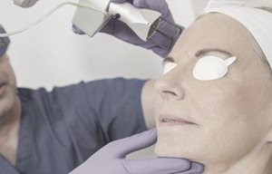 Femme se faisant faire un traitement au laser.