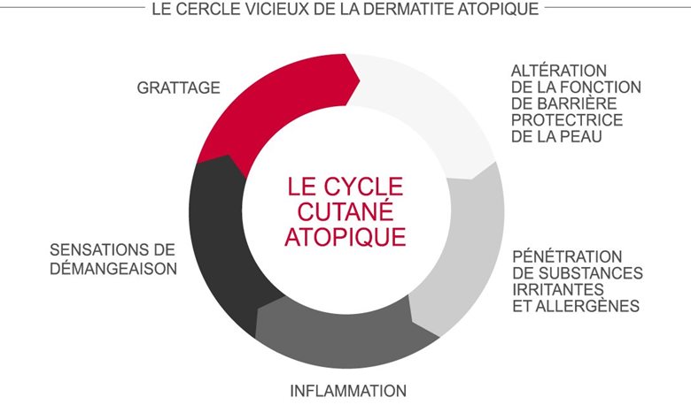 Le cercle vicieux de la dermatite atopique